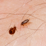 Bed Bug Bites Vs Flea Bites