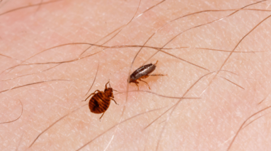 Bed Bug Bites Vs Flea Bites