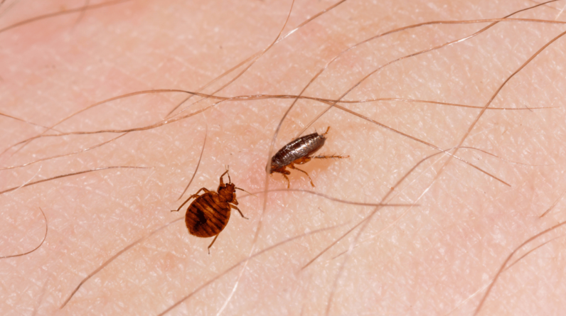 Bed Bug Bites Vs Flea Bites Spotting The Difference Pest Control Helper